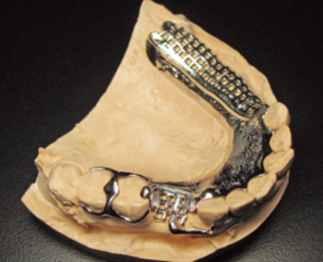 利用牙科三维打印技术实现商业成功的准确性
