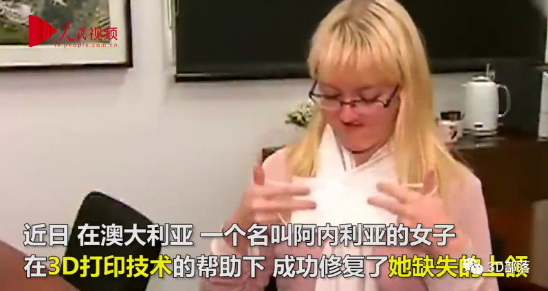 3D打印还你一个上颌！澳大利亚患癌女子借助技术恢复美丽容颜