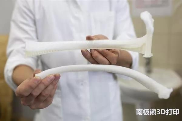 保加利亚患者接受首例3D打印肋骨植入，FDM技术打印