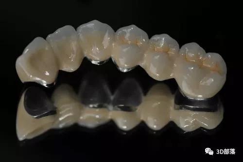 深度：3D打印在口腔美学修复中的应用