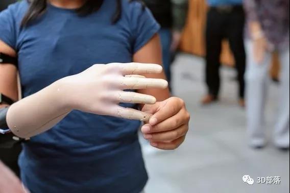 3D打印又立功了！这款高科技假肢不仅逼真 还能借助AI“记忆”日常动作