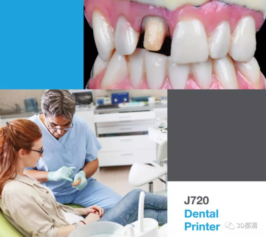 新型Stratasys J720牙科3D打印机可在一次打印中生成全彩色，多材料部件