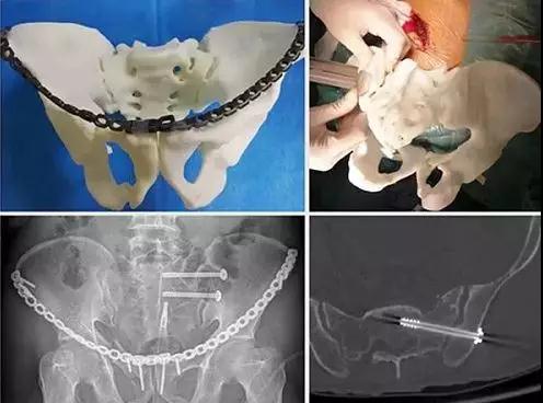 自贡四院特色技术 || 3D打印竟能重现腹中胎儿？让你提前看看未出生的孩子！