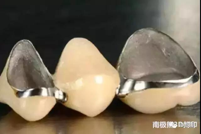 深度解析 | 3D打印钴铬烤瓷牙齿的应用