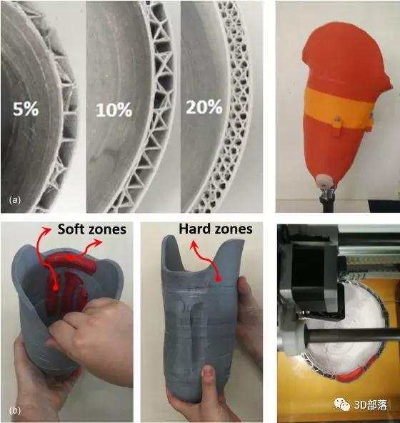 3D打印多材料柔性假肢接受腔