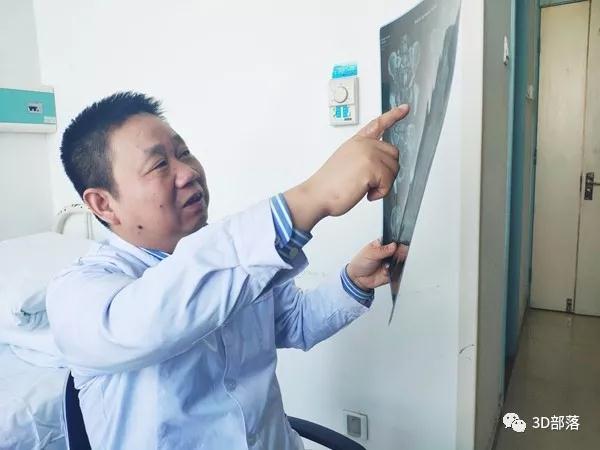 西安市红会医院创西北第一例3D打印助力骶神经调节手术