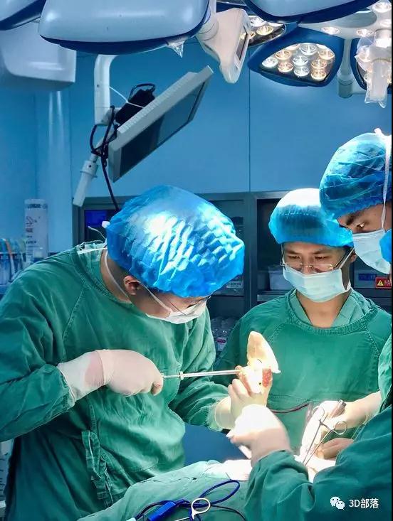 3D打印“私人订制”手术辅助导板治疗寰椎骨折