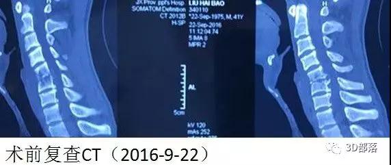董谢平： 数字骨科修行者的人生数字
