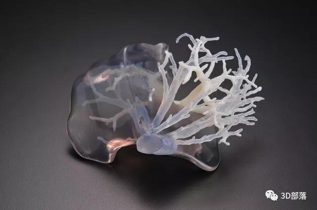 “透视”技术为精确3D打印人体器官带来曙光