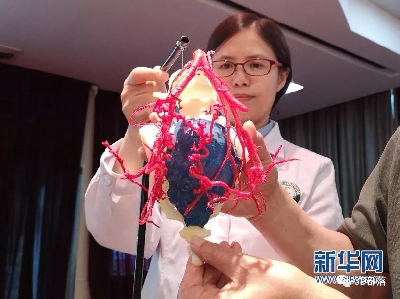 高难度脊柱巨大肿瘤切除暨3D打印腰骶联合置换术在西安完成