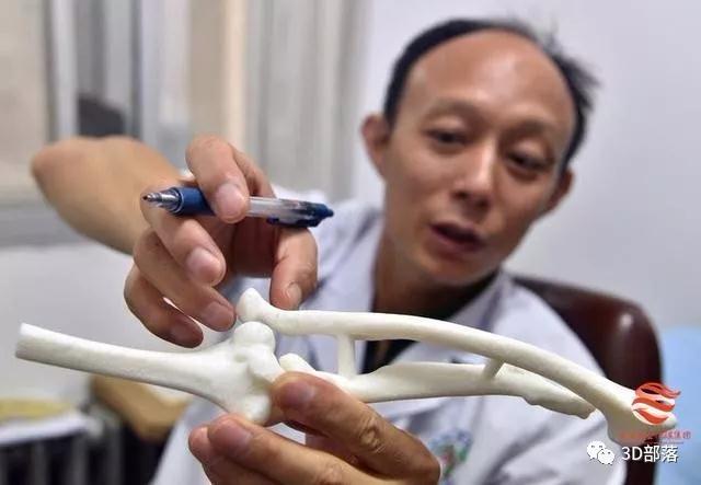 3D打印为18岁少女“再生”完美左臂，西北首例尺桡骨截骨矫形桡骨头移植尺骨头重建术在西安完成