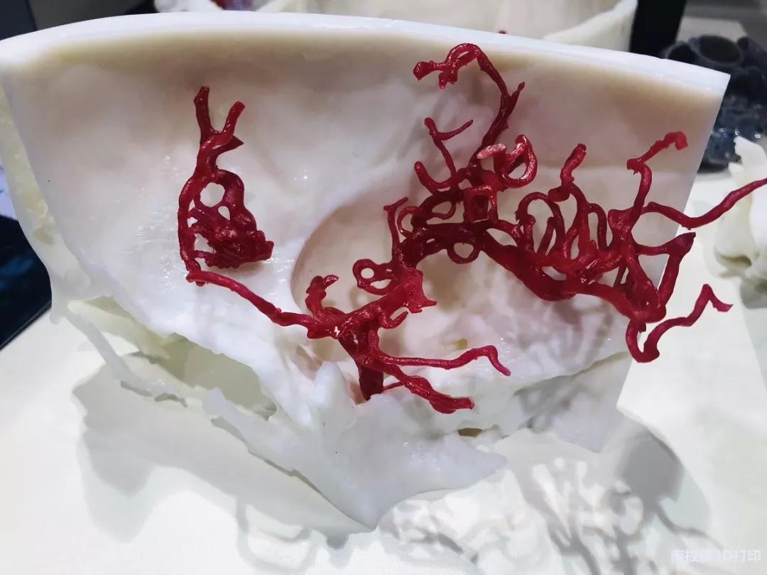医院现场打印成趋势，axial3D在皇家维多利亚医院建立了3D打印实验室