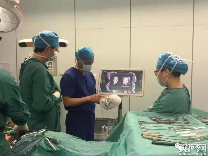 3D打印、三维重建，20岁女孩车祸后面部缺损修复了！颅颌面整形已能精准修复