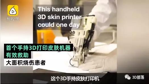 加拿大发明首个手持3D打印皮肤机