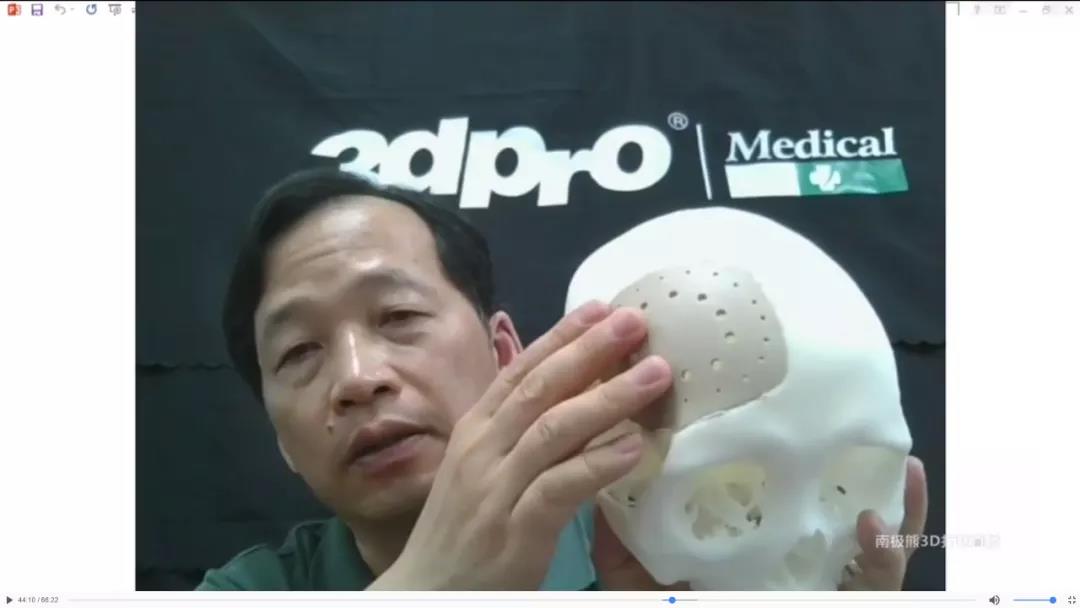 直播回看：三的部落深度解析PEEK 3D打印技术在医疗领域的应用研究