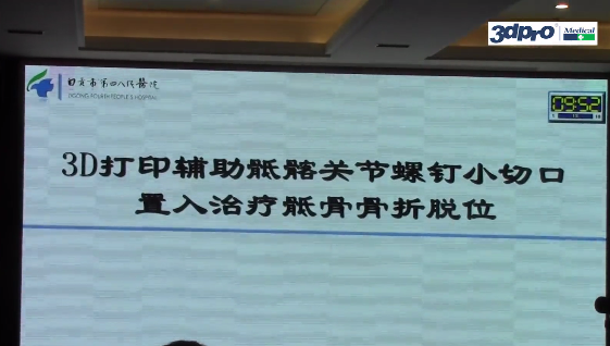 【精彩回顾】吴超主任《3D打印辅助骶髂关节螺钉小切口置入治疗骶骨骨折脱位》