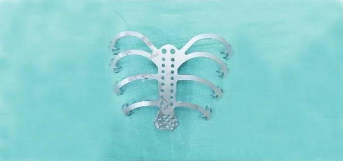 男子患胸骨肿瘤，医生给他3D打印了一套“铁骨”
