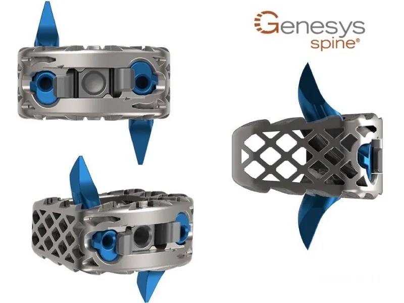 首款3D打印非螺钉式颈椎独立式保持架Genesys Spine