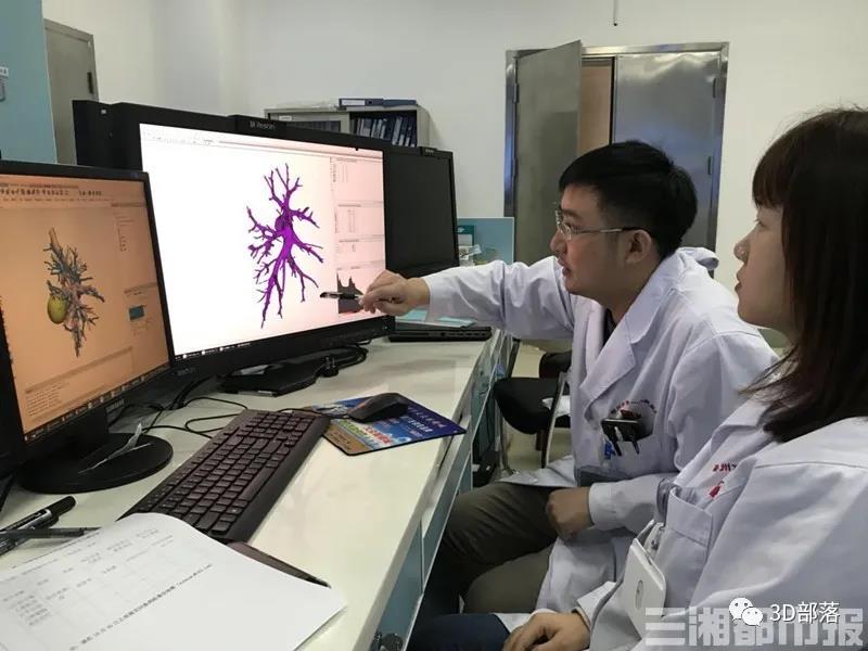 3D打印还原肺模型，郴州市第一人民医院肺癌根治术快准稳