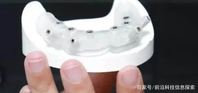 DLP 3D打印技术在齿科中的应用