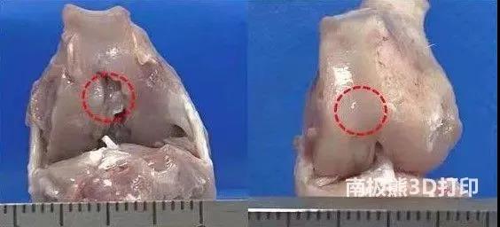 老年人膝盖疼、走路难？关节软骨老化有望用3D打印技术恢复如初