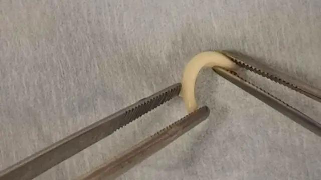 新3D打印技术可定制软骨来修复皮肤癌后的鼻子