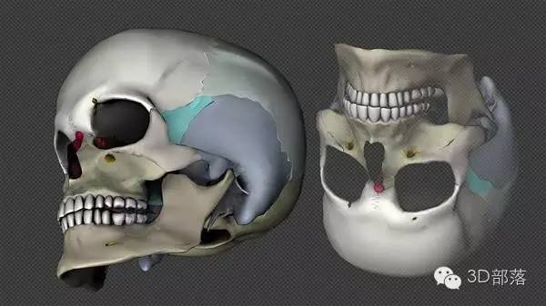 突破：爱尔兰科学家3D打印出大型软骨植入物