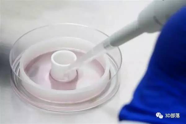 对抗心脏病的“环堆叠法”：用3D打印导板制作定制血管