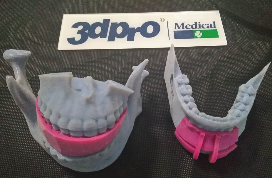 【经验分享】3D打印技术在正颌手术的应用