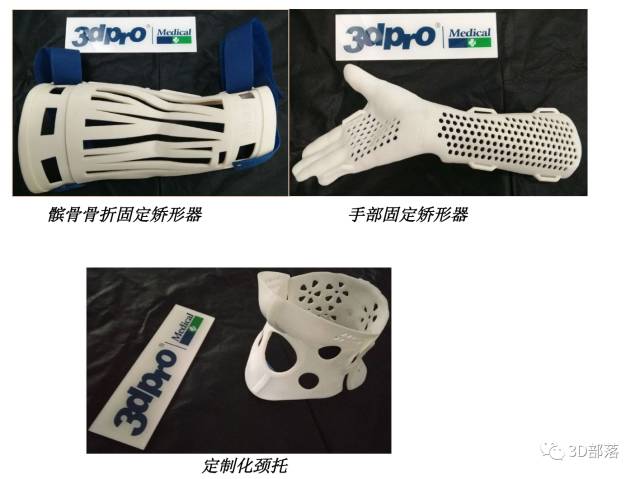 【知识分享】定制化3D打印矫形器