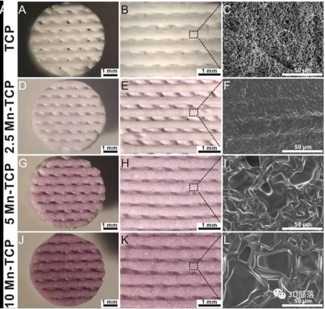 3D打印生物陶瓷用于骨、软骨修复研究获系列进展