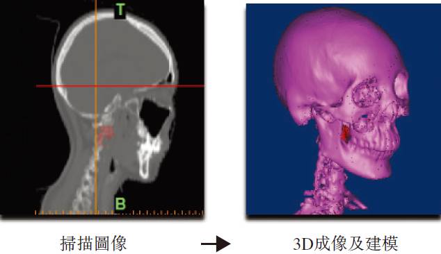 【港股通】爱康医疗：3D打印第一股