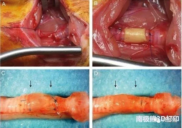 【解析】面向组织工程化软组织的制造技术及增材制造