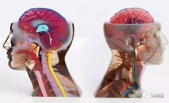 【解析】医用3D打印的新工艺与新材料是骨科植入制造的技术支撑