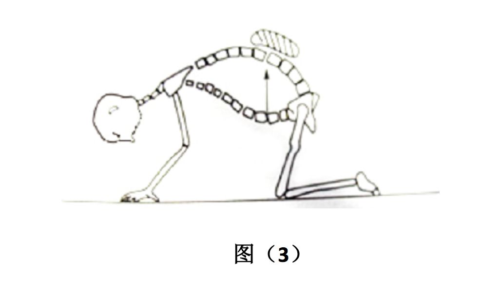 【经验分享】脊柱侧弯患者的康复治疗