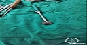 西南首例！大坪医院3D打印人工颈椎椎体植入手术获成功