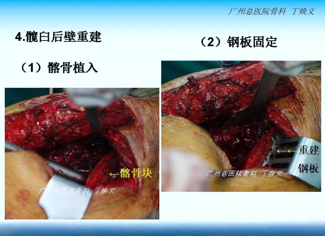 22.jpg 22.jpg