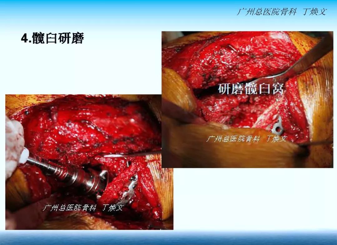 23.jpg 23.jpg
