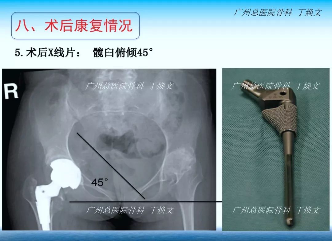 22.jpg 22.jpg
